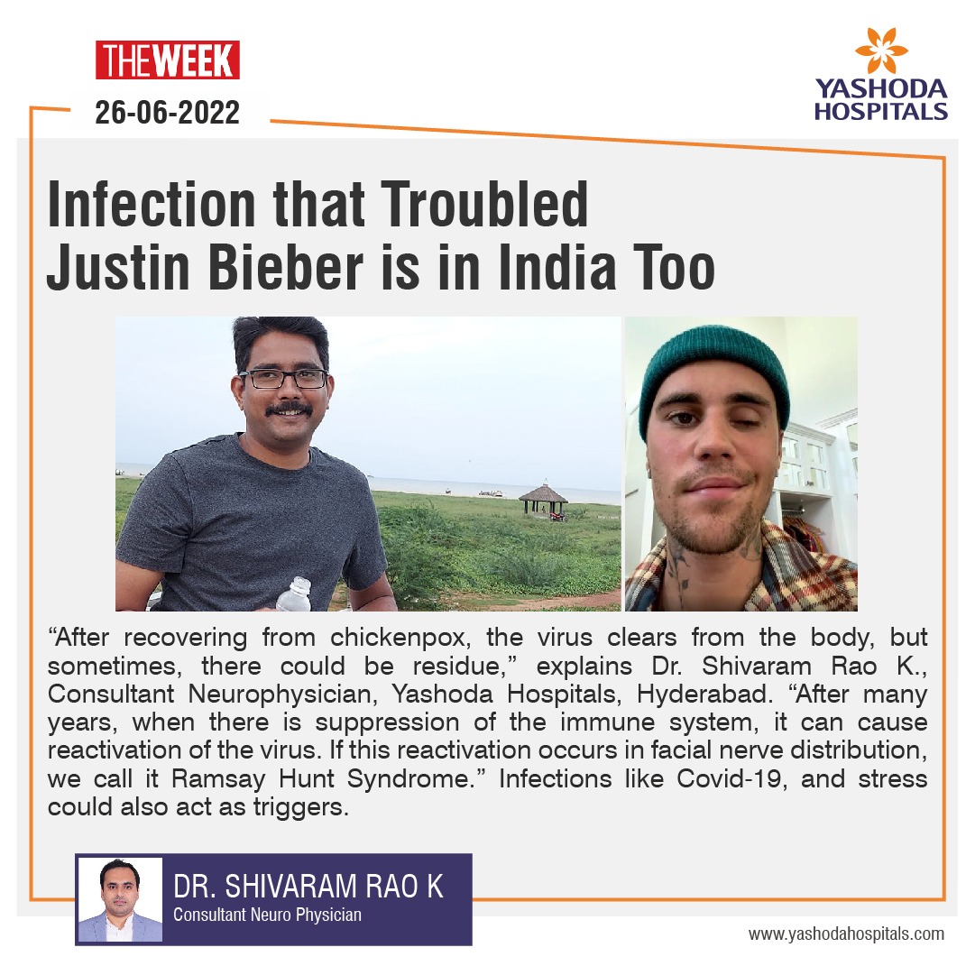 Infection that troubled Justin Bieber is in India, too