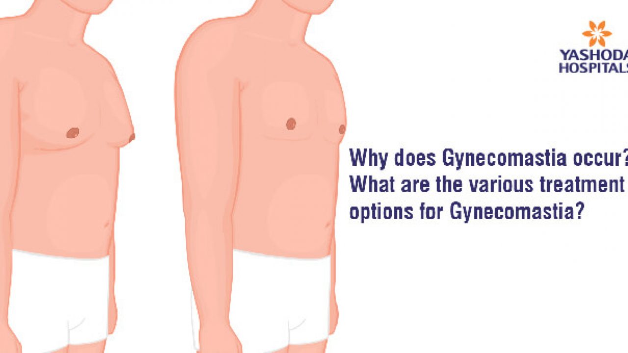 Gynecomastia: What Is Causing Your Man Boobs?