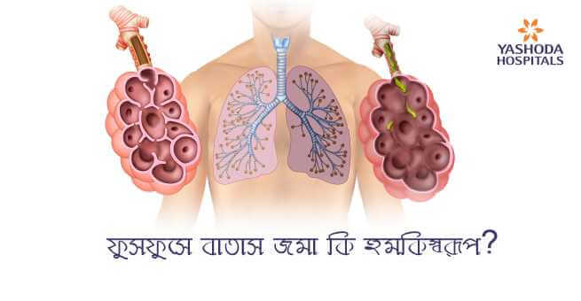air accumulation in the lungs a threat
