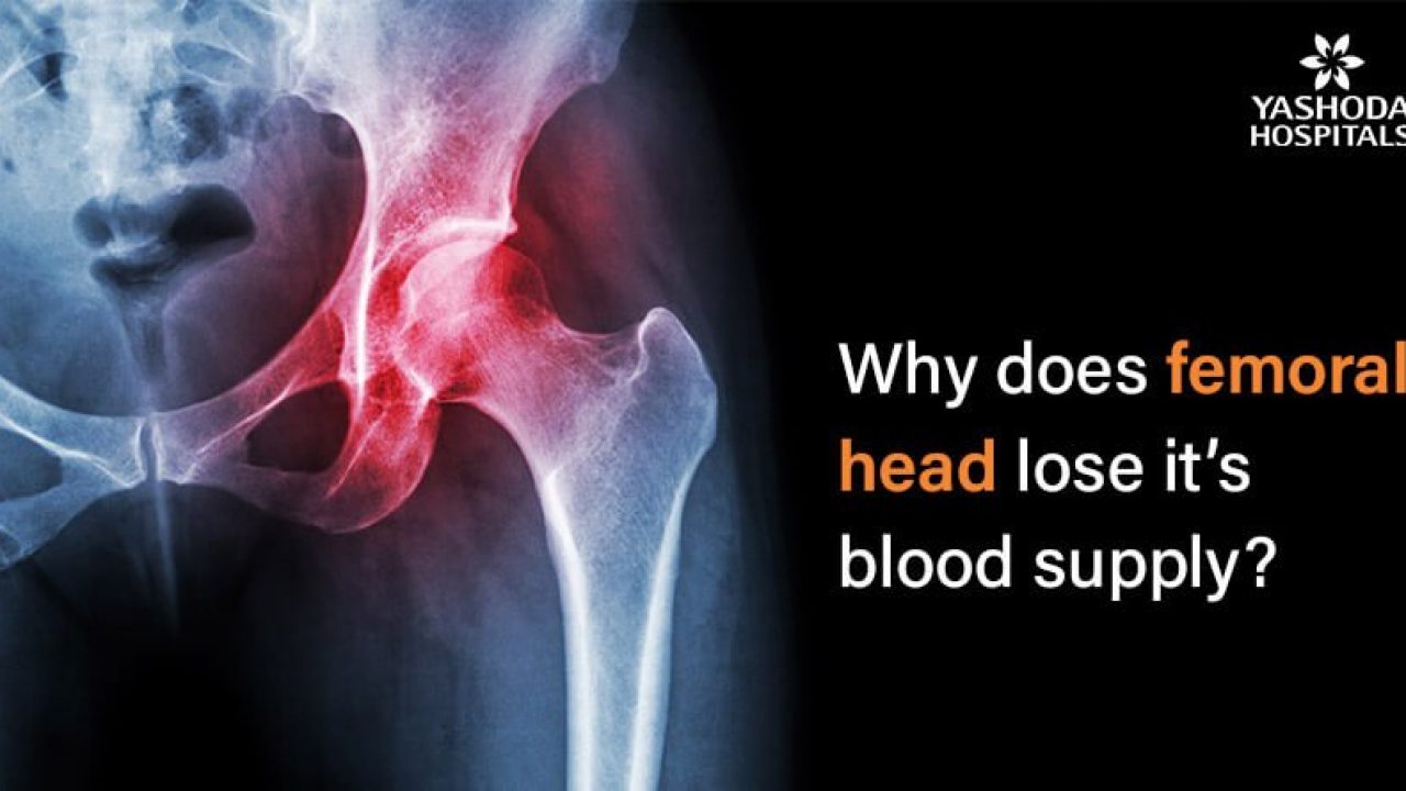 Collapsed Femoral Head