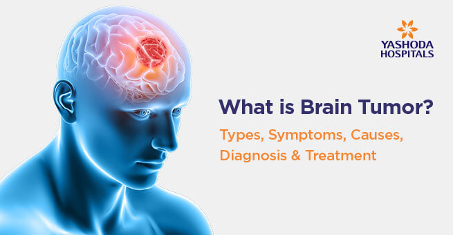 What is brain tumor