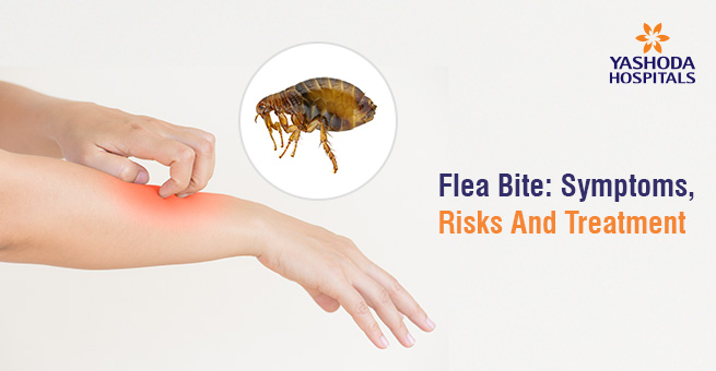 Flea Bite: Symptoms, Risks And Treatment