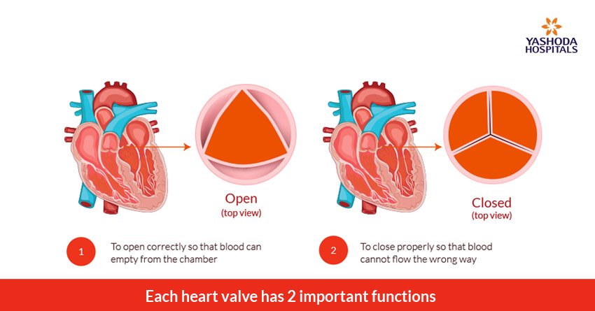 heart valve diseases
