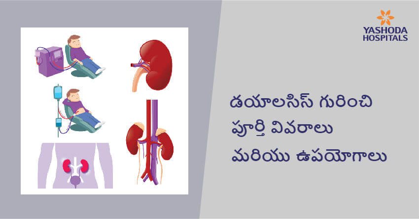 kidney-failure-dialysis-treatment