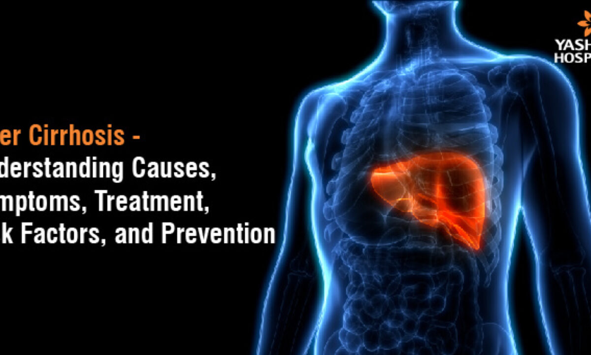 肝硬化能換肝嗎？