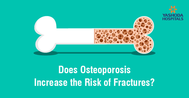 Osteoporosis Risk factors of Fractures