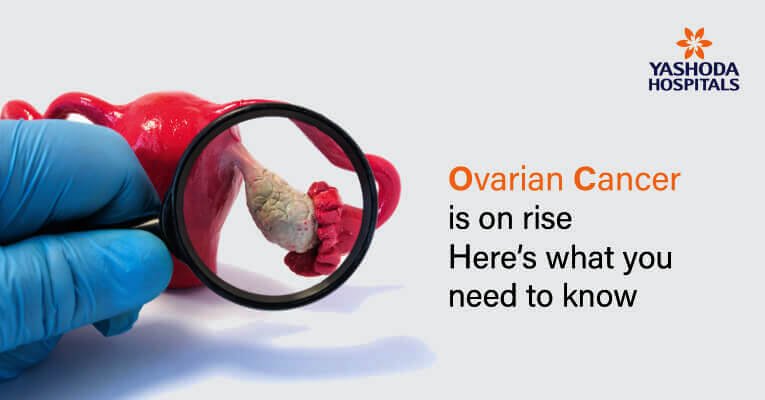 ovarian cancer- affect pregnancy