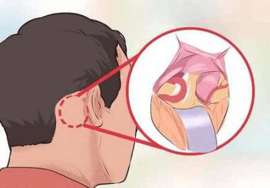 patients who are fit for surgery