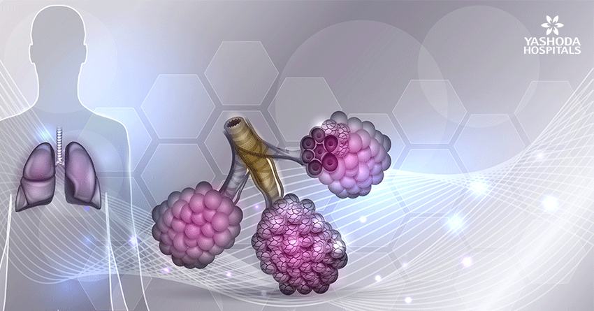 What is the relationship between pulmonary fibrosis & tuberculosis