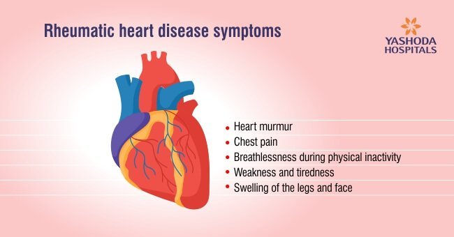 rheumatic heart disease symptoms