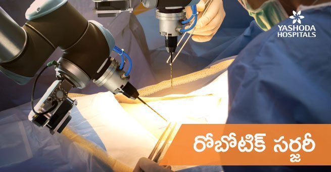 robotic surgery for kidney problems