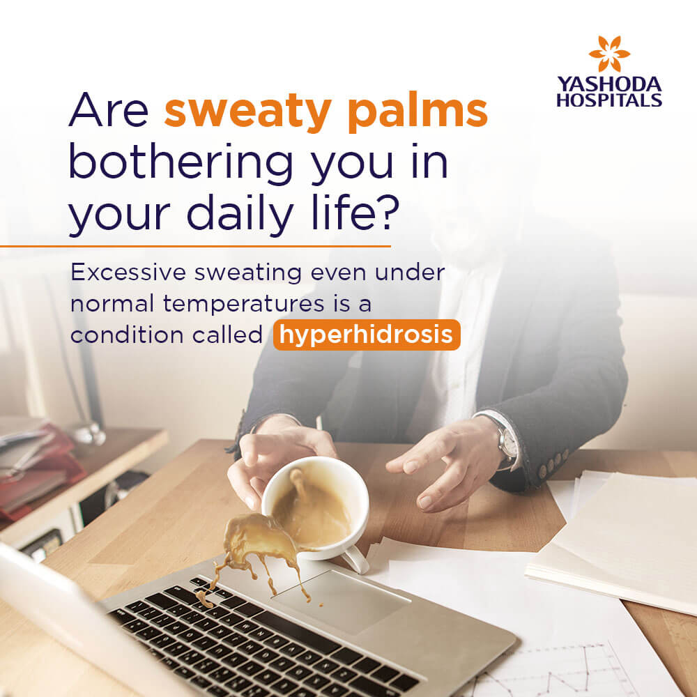 5 Signs that your sweaty palms need more care