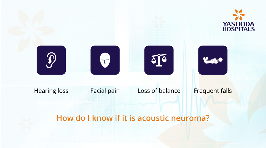 Acoustic Neuroma Symptoms, Diagnosis and Treatment