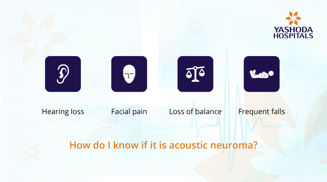 Acoustic Neuroma Symptoms, Diagnosis and Treatment