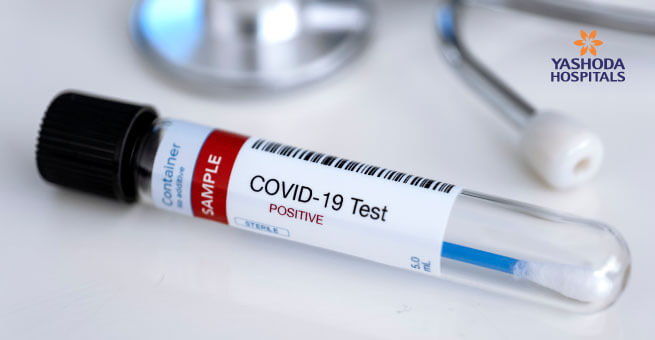 testing tube corona virus