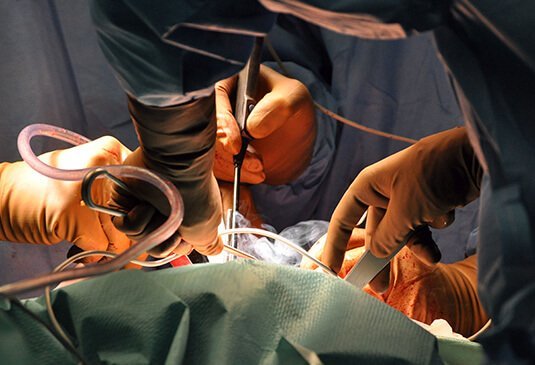 Total Hip Replacement Surgery Cost in India